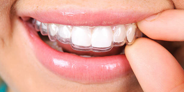 istockphoto-185281245-612×612 invisalign teeth gap