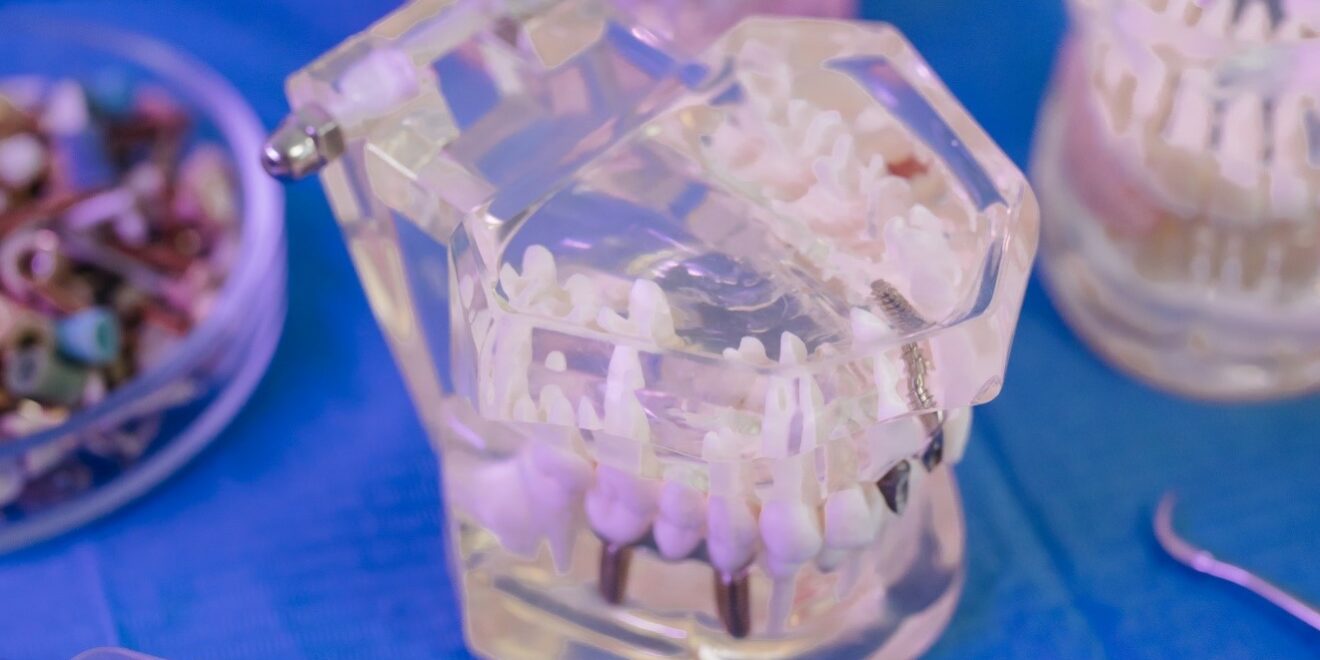 Braces band colors Braces band colors