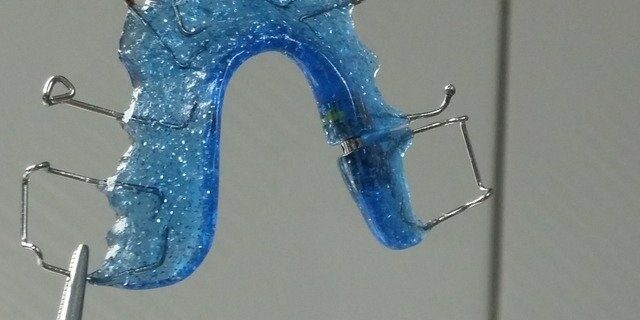 Clear retainer cost Clear retainer cost