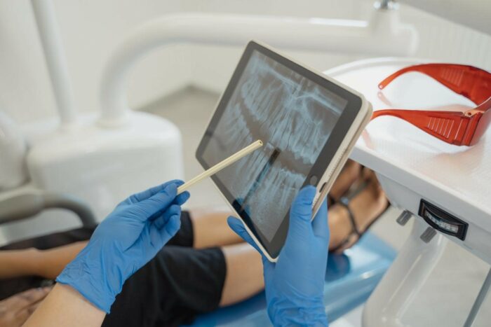 Invisalign braces cost Invisalign braces cost