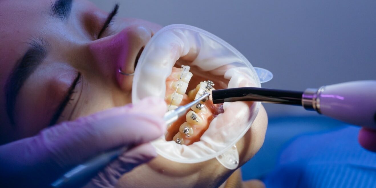 Nance appliance Nance appliance