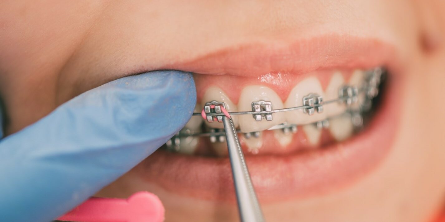 Orthodontic care specialists Orthodontic care specialists