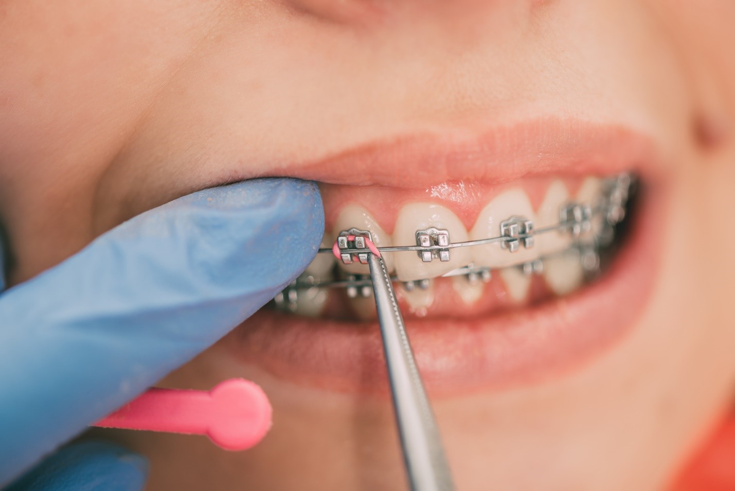 Orthodontic care specialists