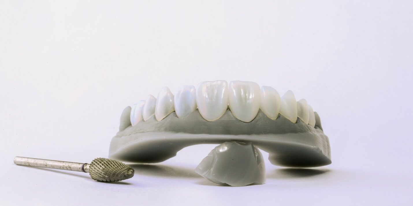 Teeth straightening Teeth straightening