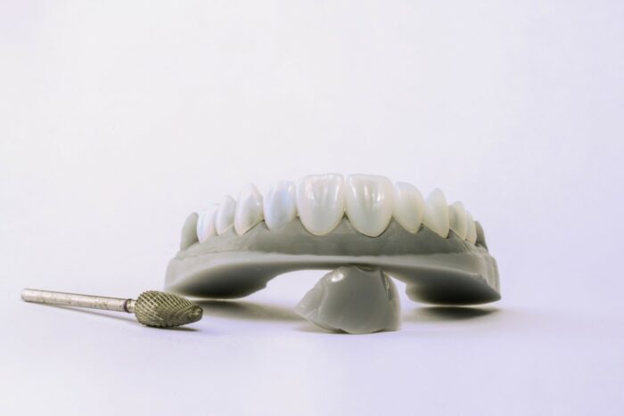Teeth straightening Teeth straightening